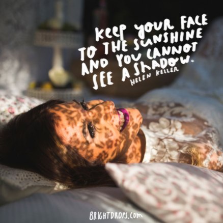 helen-keller-keep-your-face